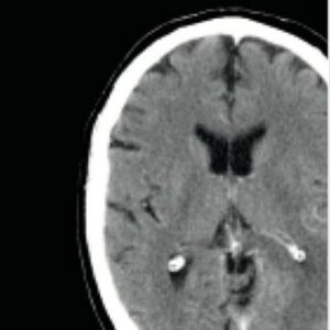 GE DISCOVERY CT750 HD