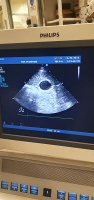 Philips HD15 Ultrasound 2
