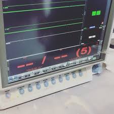 PHILIPS PANORAMA .23T OPEN