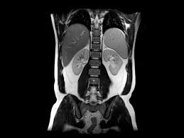 GE SIGNA VIBRANT 1.5T