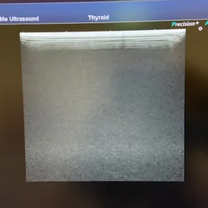 Canon Aplio 300 with 4D