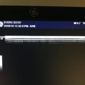 GE Logiq E9 – multiple machines available